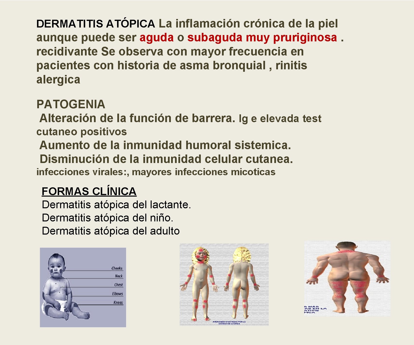 DERMATITIS ATÓPICA La inflamación crónica de la piel aunque puede ser aguda o subaguda