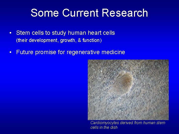 Some Current Research • Stem cells to study human heart cells (their development, growth, Some Current Research • Stem cells to study human heart cells (their development, growth,