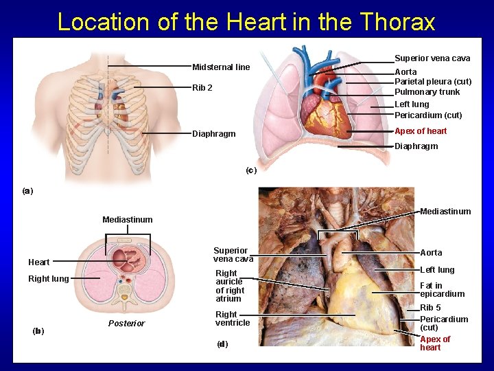 Location of the Heart in the Thorax Midsternal line Rib 2 Superior vena cava Location of the Heart in the Thorax Midsternal line Rib 2 Superior vena cava