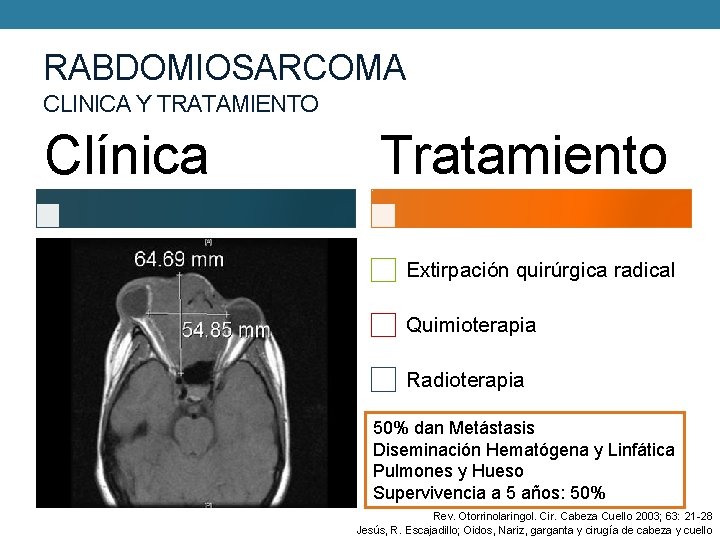 RABDOMIOSARCOMA CLINICA Y TRATAMIENTO Clínica Tratamiento Extirpación quirúrgica radical Quimioterapia Radioterapia 50% dan Metástasis