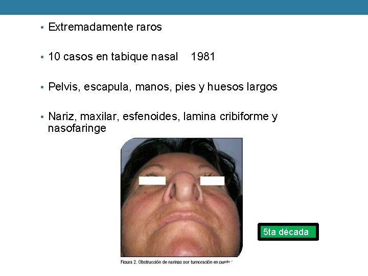  • Extremadamente raros • 10 casos en tabique nasal 1981 • Pelvis, escapula,