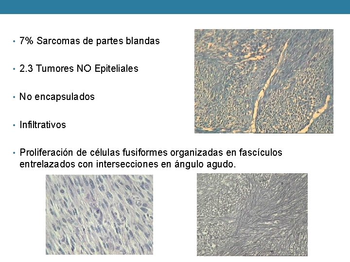  • 7% Sarcomas de partes blandas • 2. 3 Tumores NO Epiteliales •