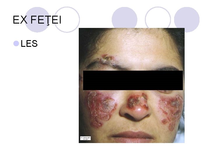EX FEŢEI l LES EX FEŢEI l LES