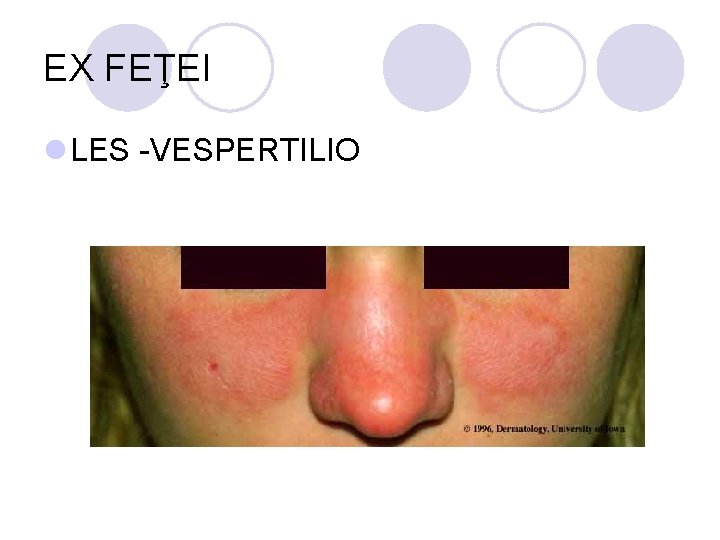 EX FEŢEI l LES -VESPERTILIO EX FEŢEI l LES -VESPERTILIO