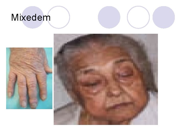 Mixedem Mixedem