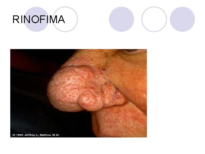 RINOFIMA RINOFIMA