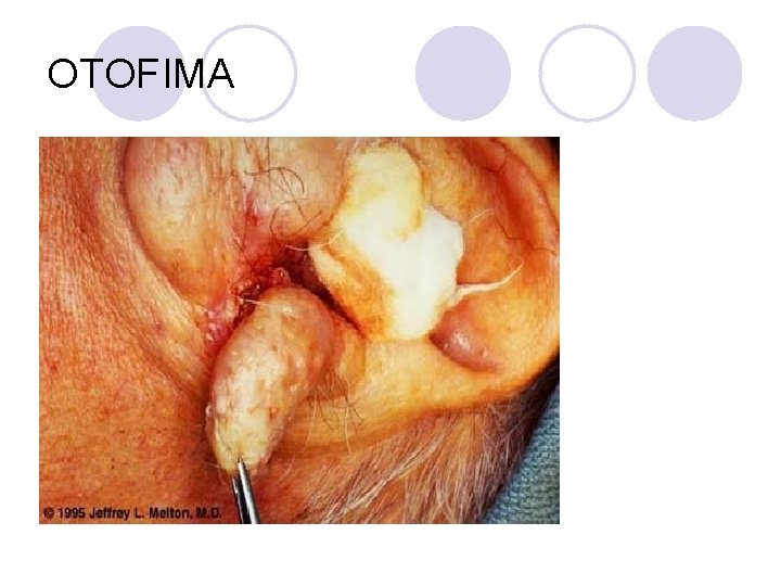 OTOFIMA OTOFIMA