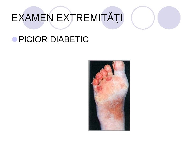 EXAMEN EXTREMITĂŢI l PICIOR DIABETIC EXAMEN EXTREMITĂŢI l PICIOR DIABETIC