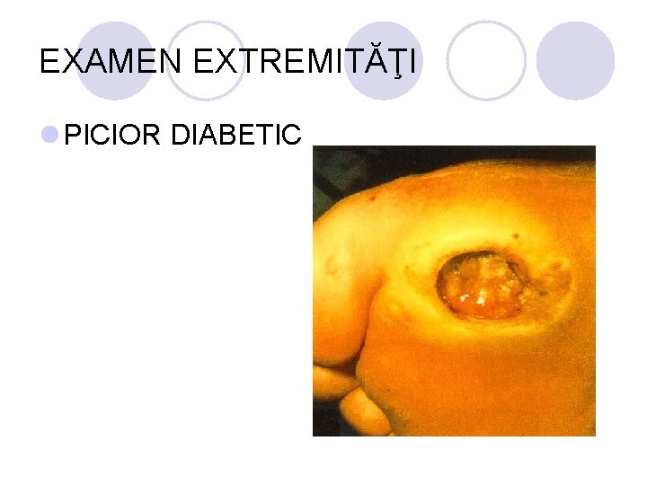 EXAMEN EXTREMITĂŢI l PICIOR DIABETIC EXAMEN EXTREMITĂŢI l PICIOR DIABETIC