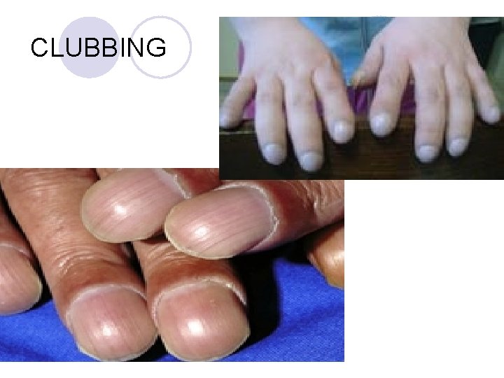 CLUBBING CLUBBING