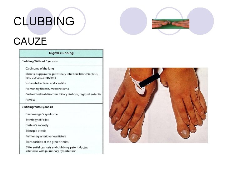 CLUBBING CAUZE CLUBBING CAUZE