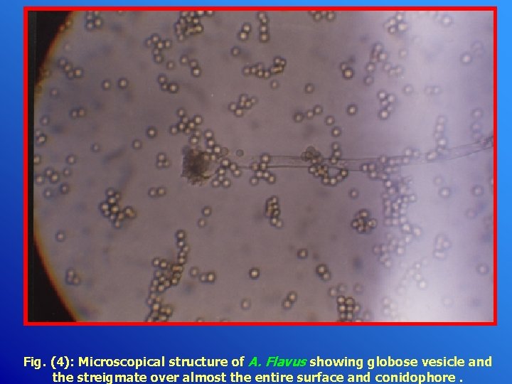 Fig. (4): Microscopical structure of A. Flavus showing globose vesicle and the streigmate over