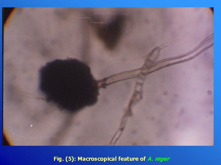 Fig. (5): Macroscopical feature of A. niger 