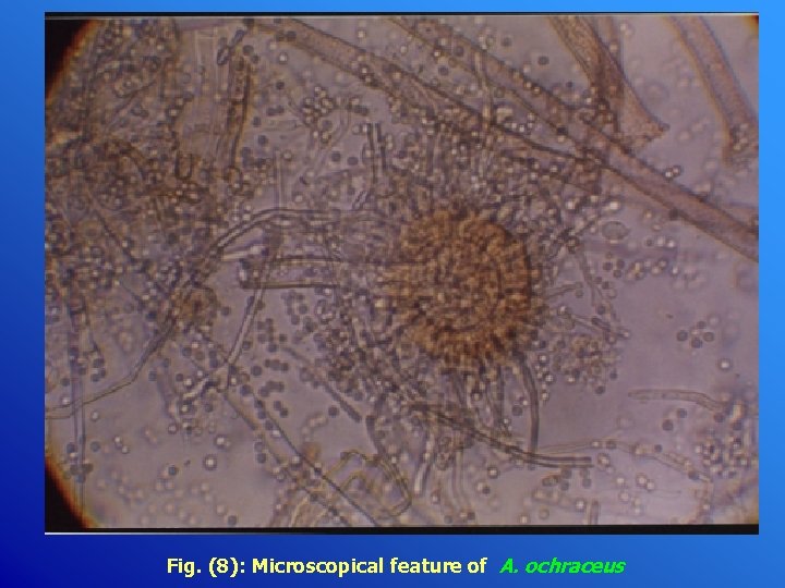 Fig. (8): Microscopical feature of A. ochraceus 
