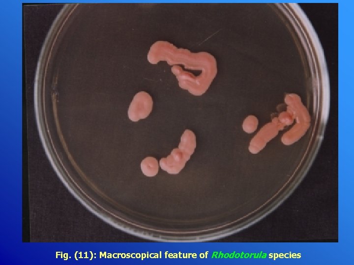 Fig. (11): Macroscopical feature of Rhodotorula species 