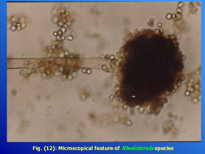 Fig. (12): Microscopical feature of Rhodotorula species 