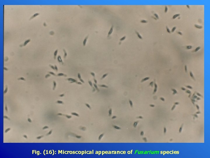 Fig. (16): Microscopical appearance of Fusarium species 