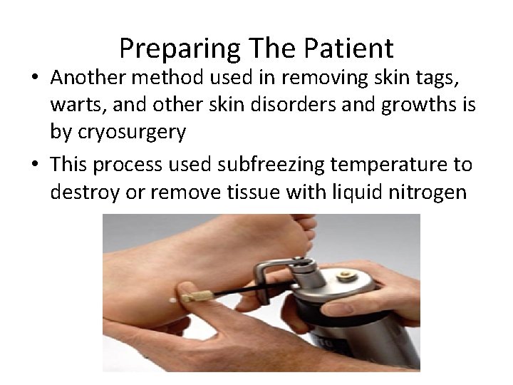 Preparing The Patient • Another method used in removing skin tags, warts, and other