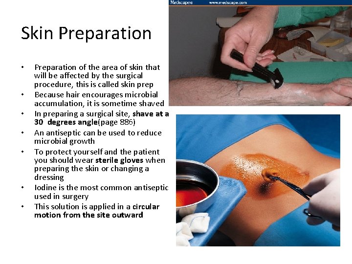 Skin Preparation • • Preparation of the area of skin that will be affected