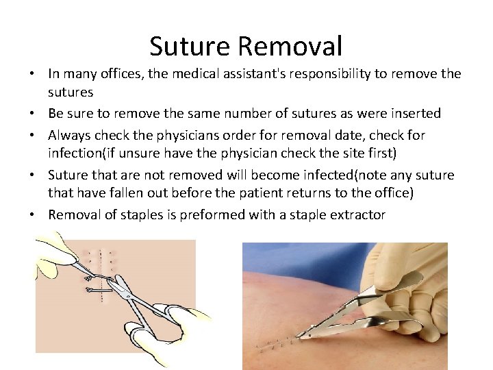 Suture Removal • In many offices, the medical assistant's responsibility to remove the sutures