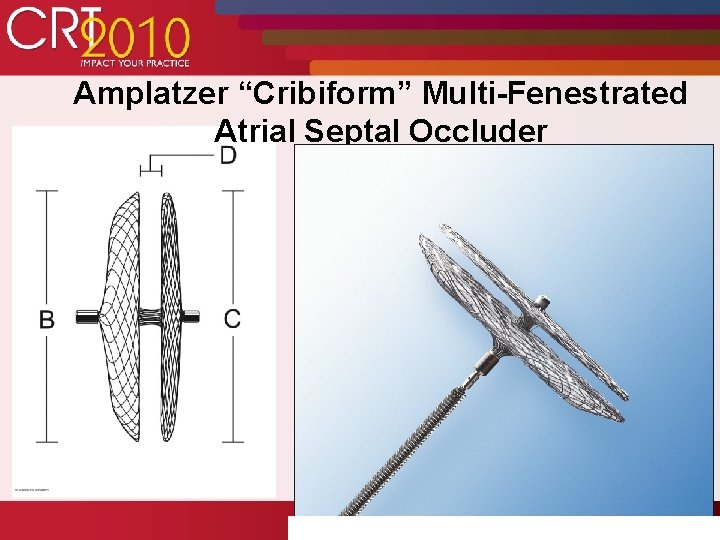 Amplatzer “Cribiform” Multi-Fenestrated Atrial Septal Occluder 