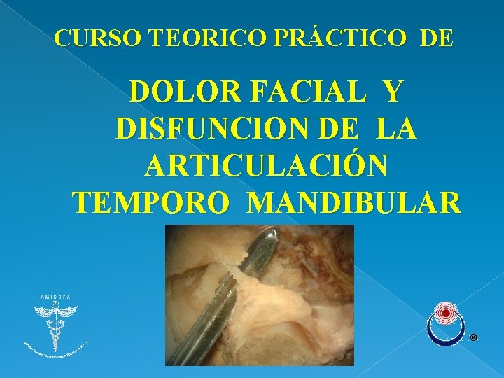 CURSO TEORICO PRÁCTICO DE DOLOR FACIAL Y DISFUNCION DE LA ARTICULACIÓN TEMPORO MANDIBULAR 