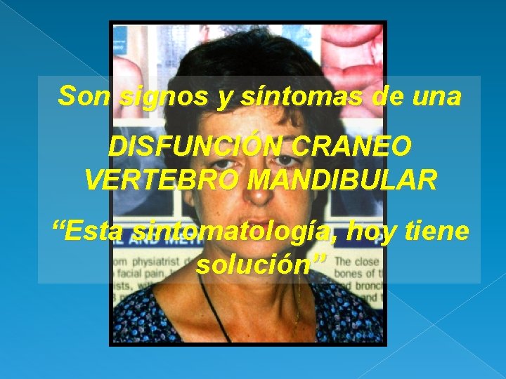 Son signos y síntomas de una DISFUNCIÓN CRANEO VERTEBRO MANDIBULAR “Esta sintomatología, hoy tiene