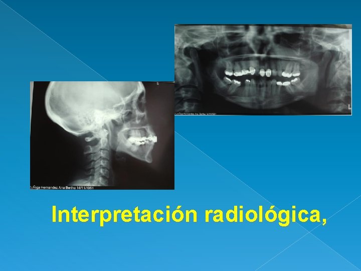 Interpretación radiológica, 