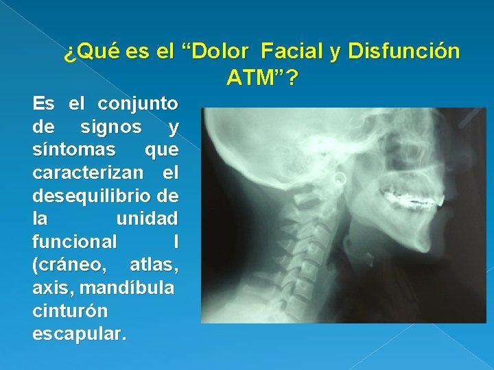 ¿Qué es el “Dolor Facial y Disfunción ATM”? Es el conjunto de signos y
