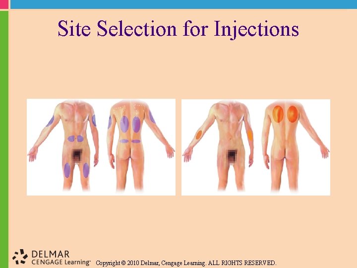 Site Selection for Injections Copyright © 2010 Delmar, Cengage Learning. ALL RIGHTS RESERVED. 