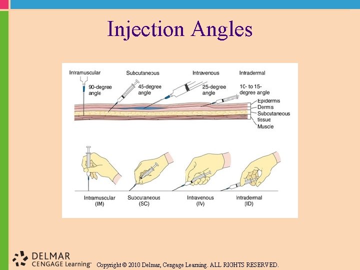 Injection Angles Copyright © 2010 Delmar, Cengage Learning. ALL RIGHTS RESERVED. 