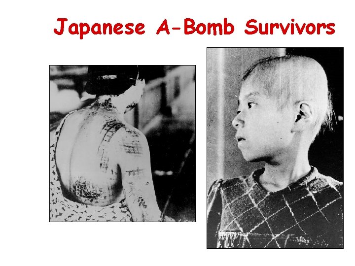 Japanese A-Bomb Survivors 