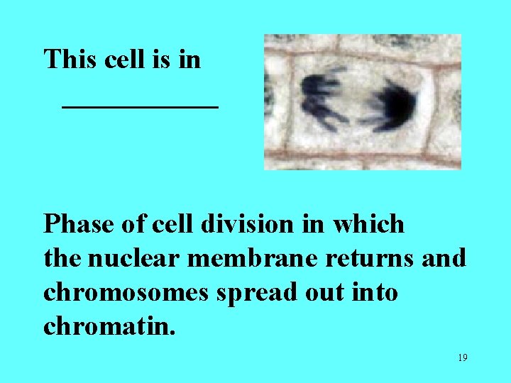 This cell is in ______ Phase of cell division in which the nuclear membrane This cell is in ______ Phase of cell division in which the nuclear membrane