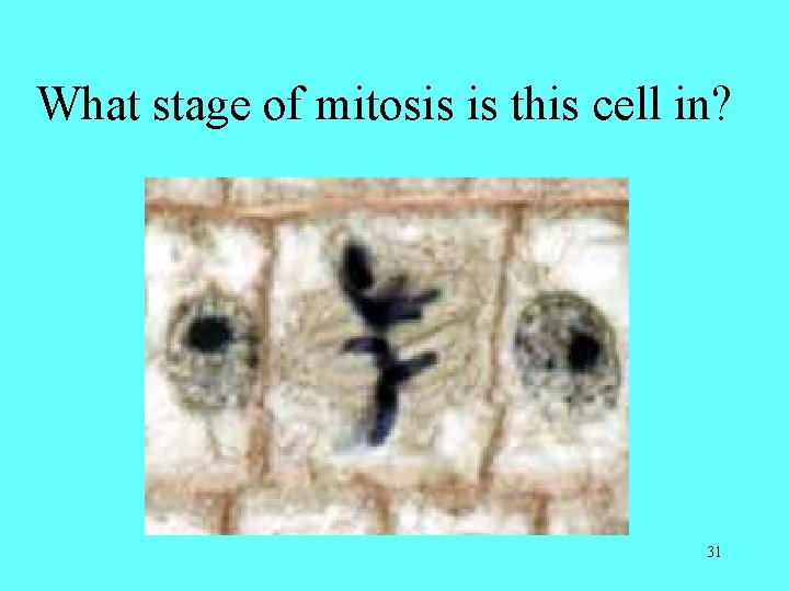 What stage of mitosis is this cell in? 31 What stage of mitosis is this cell in? 31