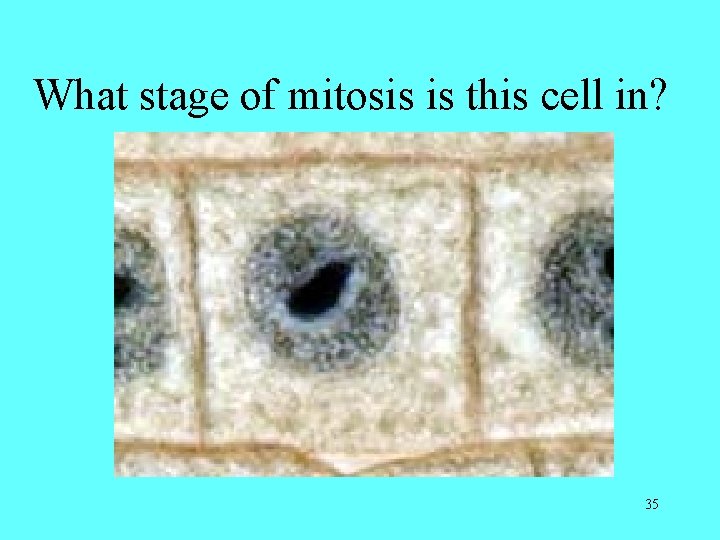 What stage of mitosis is this cell in? 35 What stage of mitosis is this cell in? 35