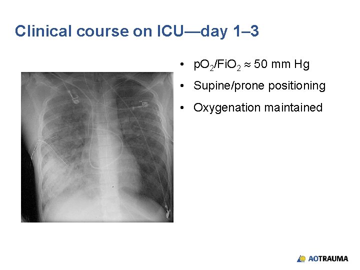 Clinical course on ICU—day 1– 3 • p. O 2/Fi. O 2 50 mm