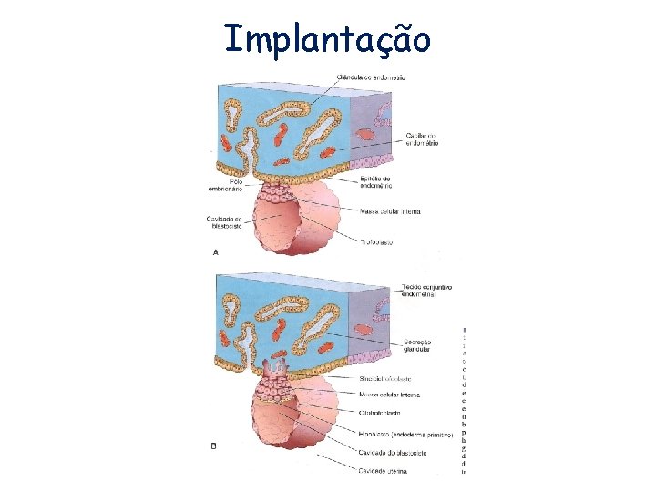 Implantação 