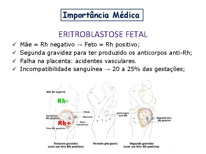 Importância Médica ERITROBLASTOSE FETAL ü ü Mãe = Rh negativo → Feto = Rh