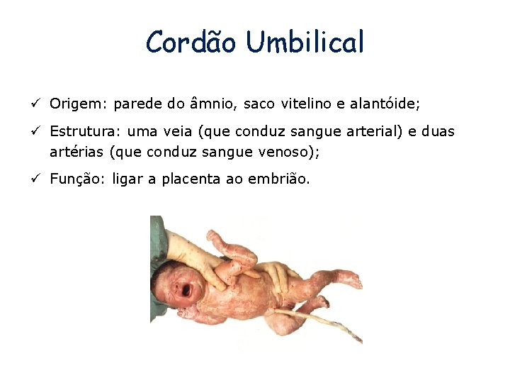 Cordão Umbilical ü Origem: parede do âmnio, saco vitelino e alantóide; ü Estrutura: uma