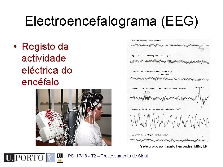 Electroencefalograma (EEG) • Registo da actividade eléctrica do encéfalo Slide criado por Fausto Fernandes,