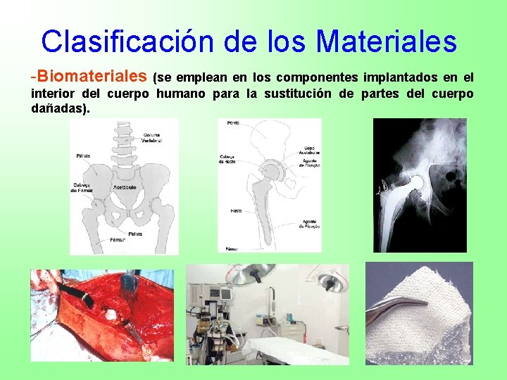 Clasificación de los Materiales -Biomateriales (se emplean en los componentes implantados en el interior