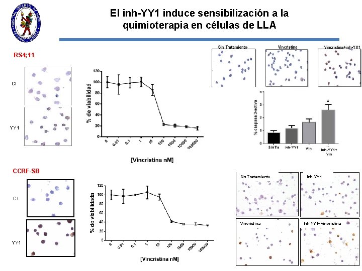 El inh-YY 1 induce sensibilización a la quimioterapia en células de LLA RS 4;