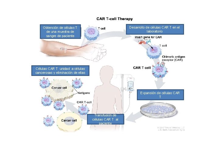 Desarrollo de células CAR T en el laboratorio Obtención de células T de una