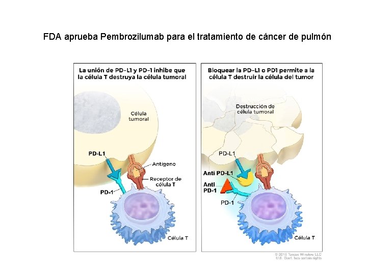 FDA aprueba Pembrozilumab para el tratamiento de cáncer de pulmón 