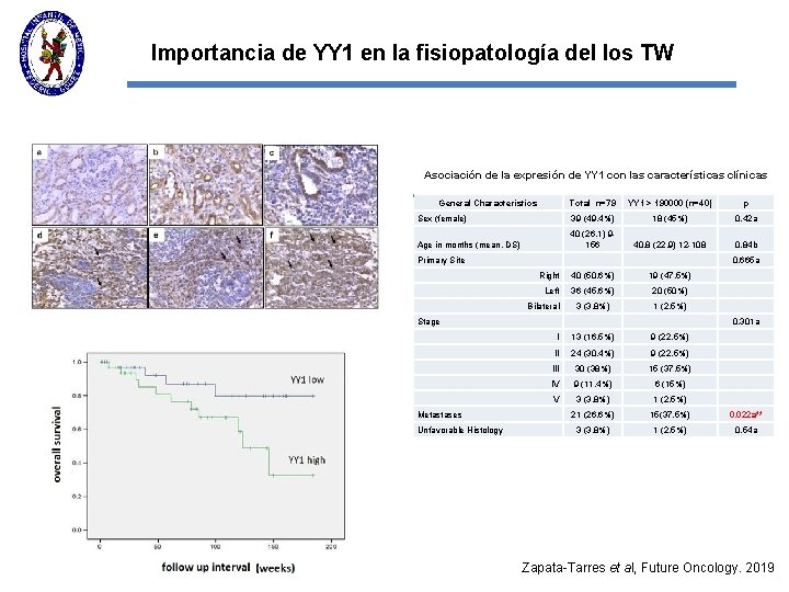 Importancia de YY 1 en la fisiopatología del los TW Asociación de la expresión