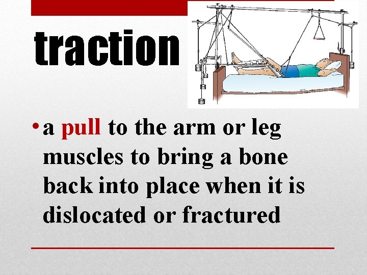 traction • a pull to the arm or leg muscles to bring a bone traction • a pull to the arm or leg muscles to bring a bone