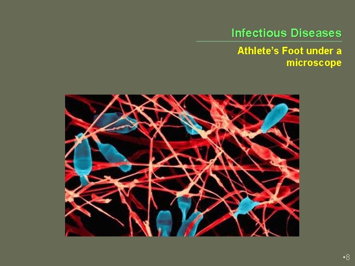 Infectious Diseases Athlete’s Foot under a microscope • 8 