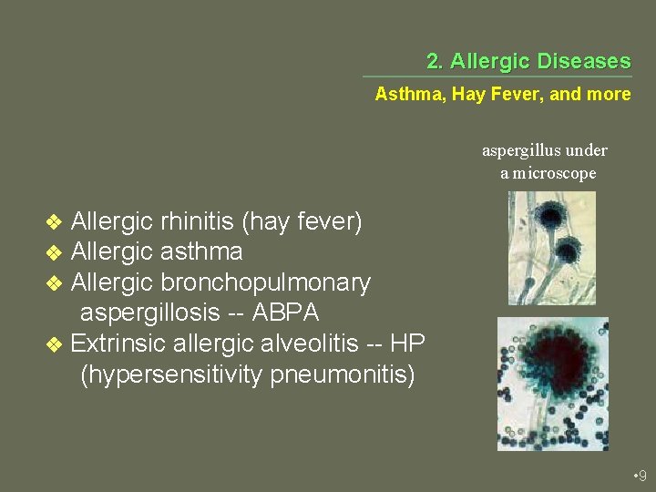 2. Allergic Diseases Asthma, Hay Fever, and more aspergillus under a microscope Allergic rhinitis
