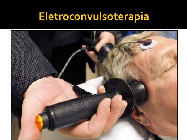 Eletroconvulsoterapia 