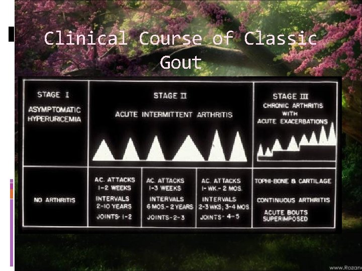 Clinical Course of Classic Gout 